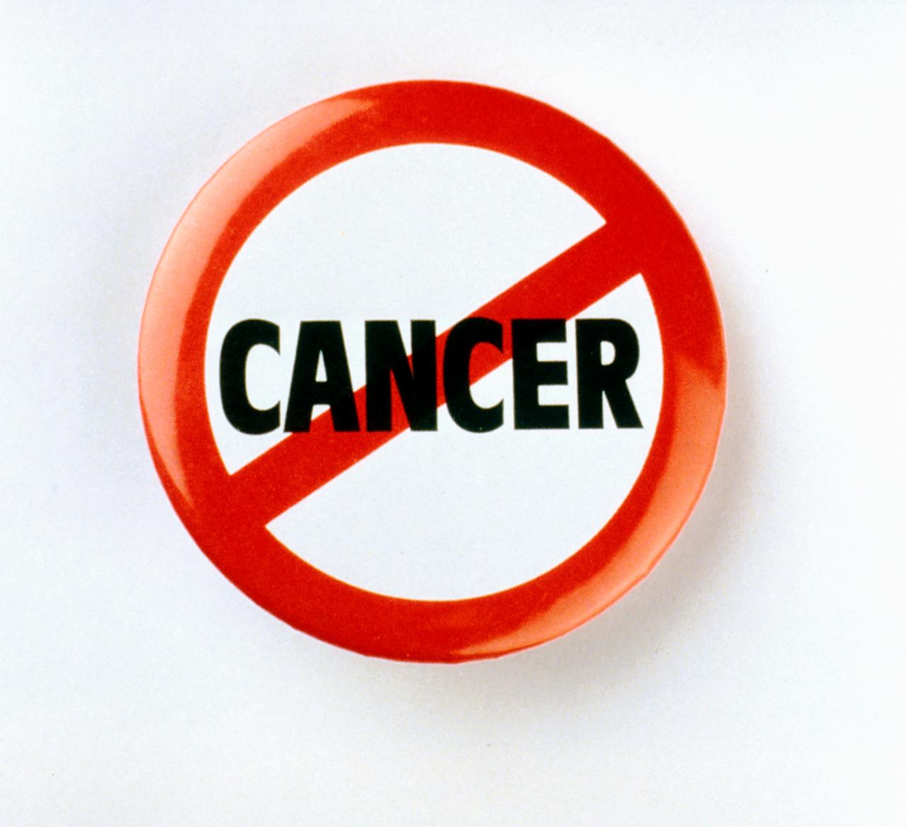 Jedan simptom raka gušterače lako je previdjeti