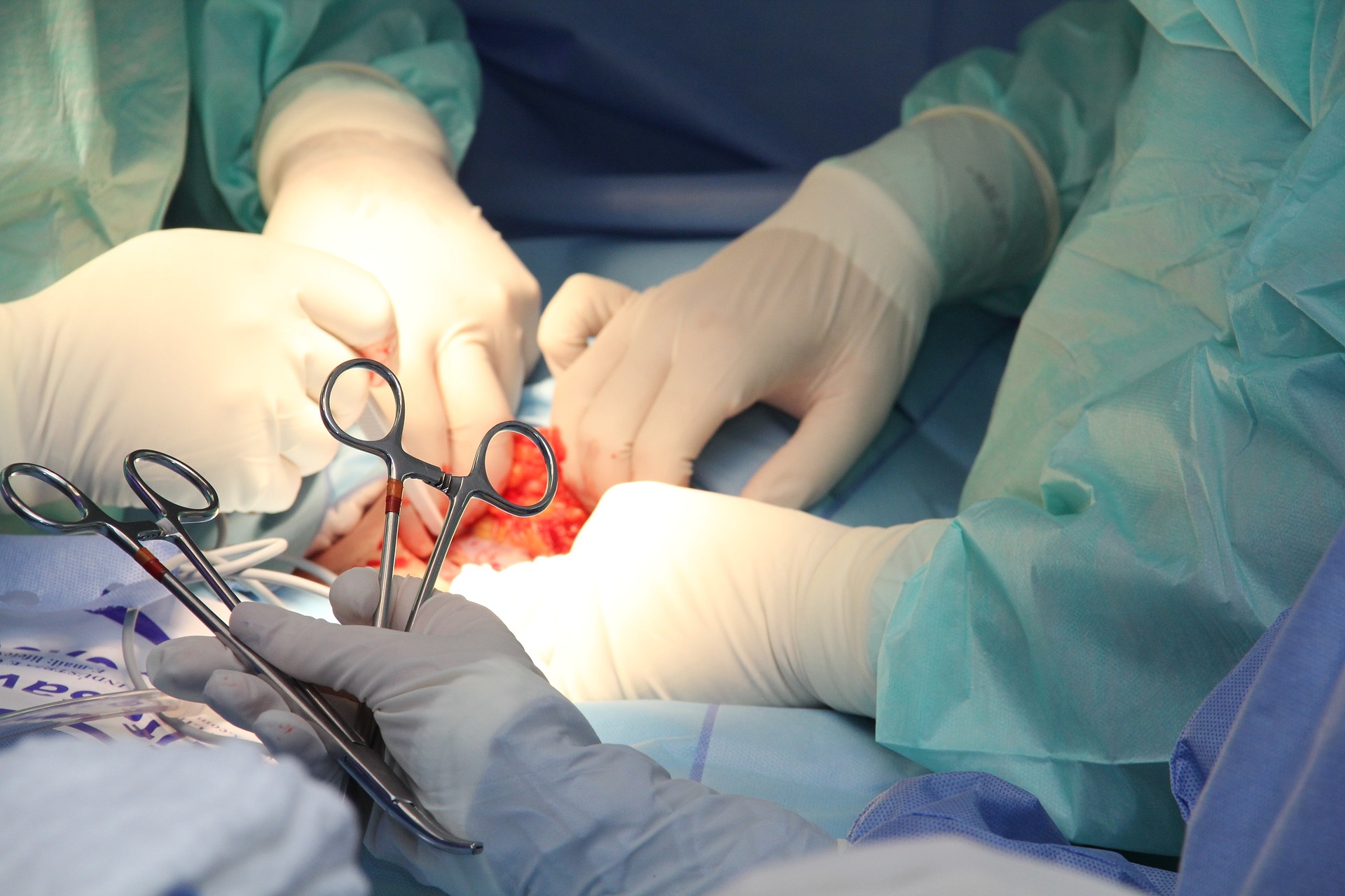 STUDIJA Žene češće umiru nakon operacije ako im je kirurg muškarac