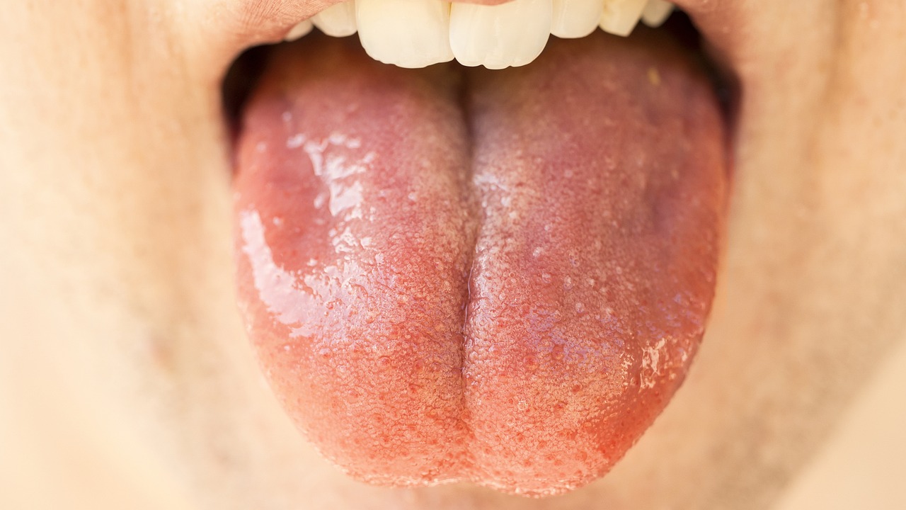 Porastao broj slučajeva raka usta, ovo su simptomi